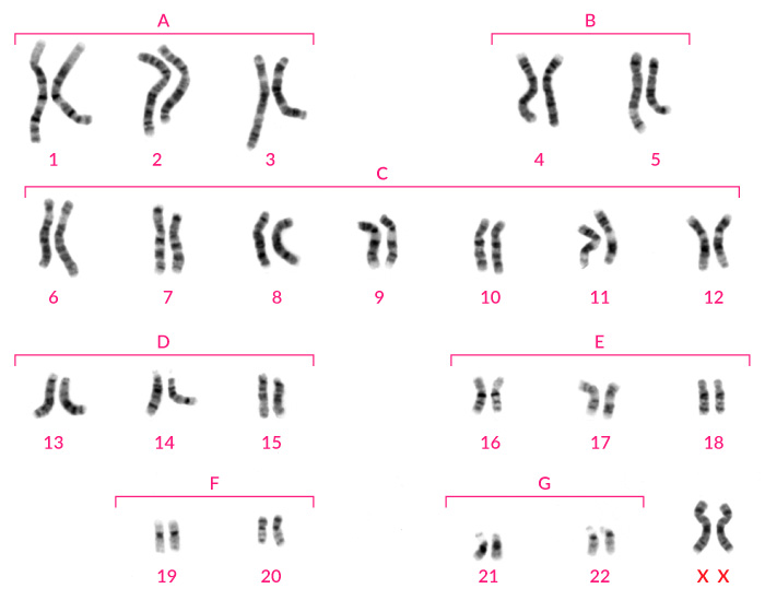 Cariotipo femenino