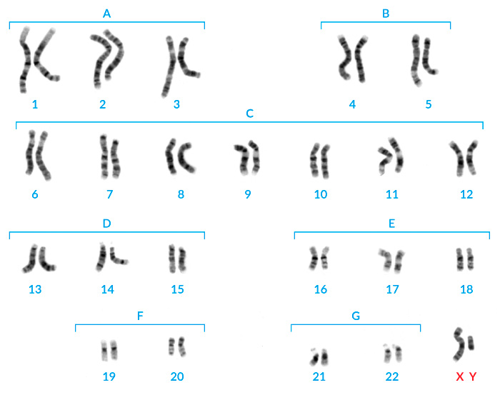 Cariotipo masculino